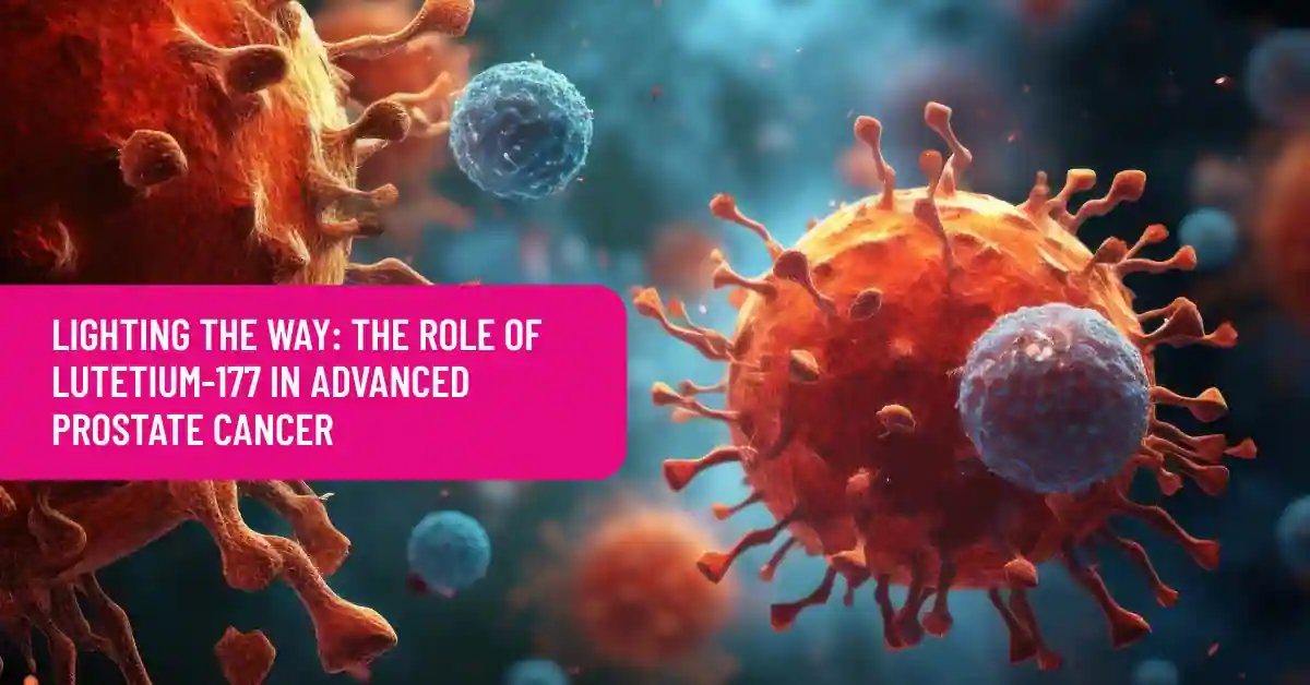 Lighting the Way: The Role of Lutetium-177 in Advanced Prostate Cancer