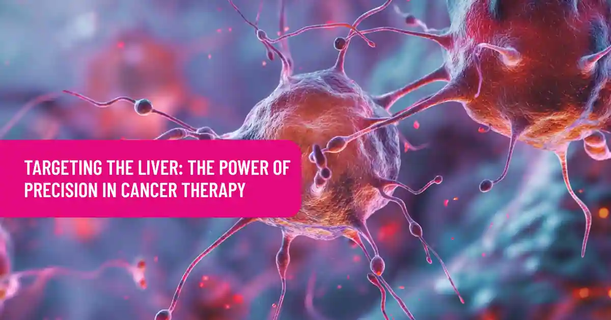Targeting the Liver: The Power of Precision in Cancer Therapy