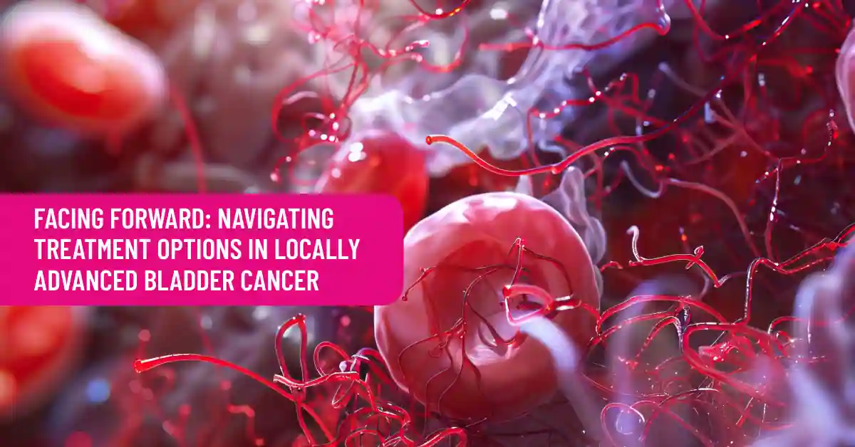 Facing Forward: Navigating Treatment Options in Locally Advanced Bladder Cancer
