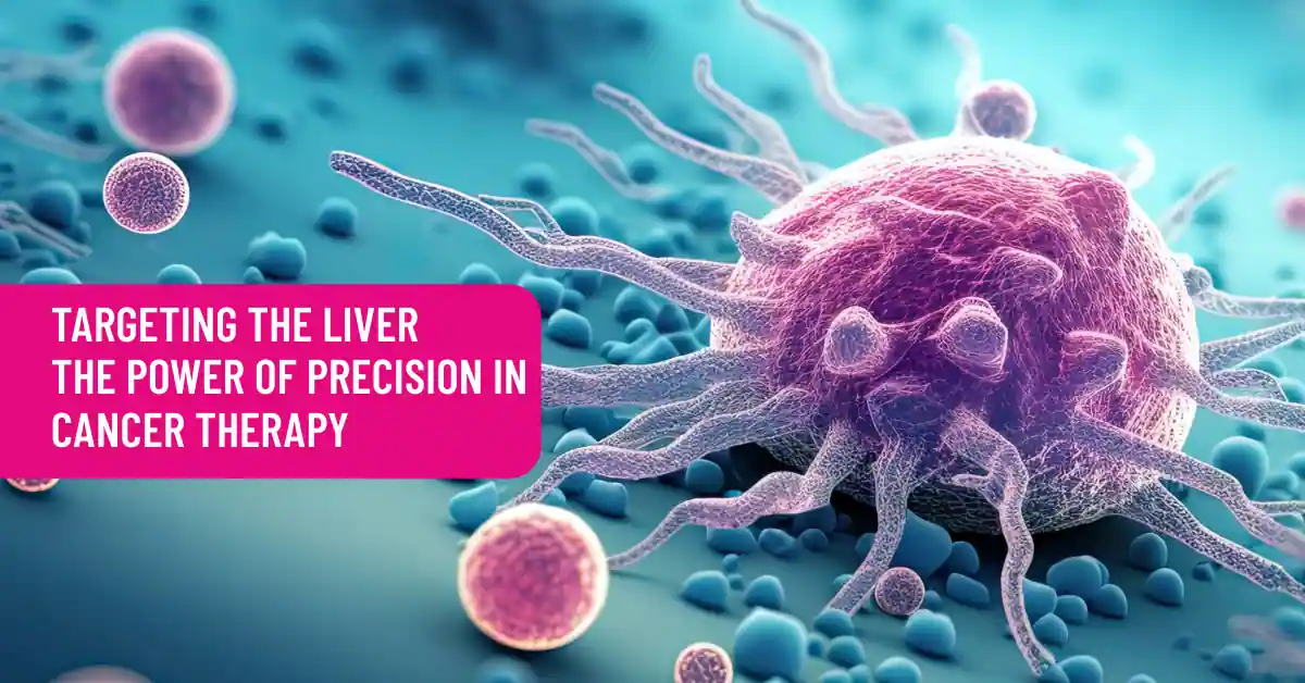 Targeting the Liver The Power of Precision in Cancer Therapy